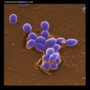 enteococcus under electron microscope, SEM